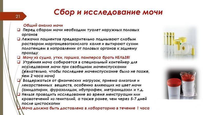 Подготовка к сдаче мочи