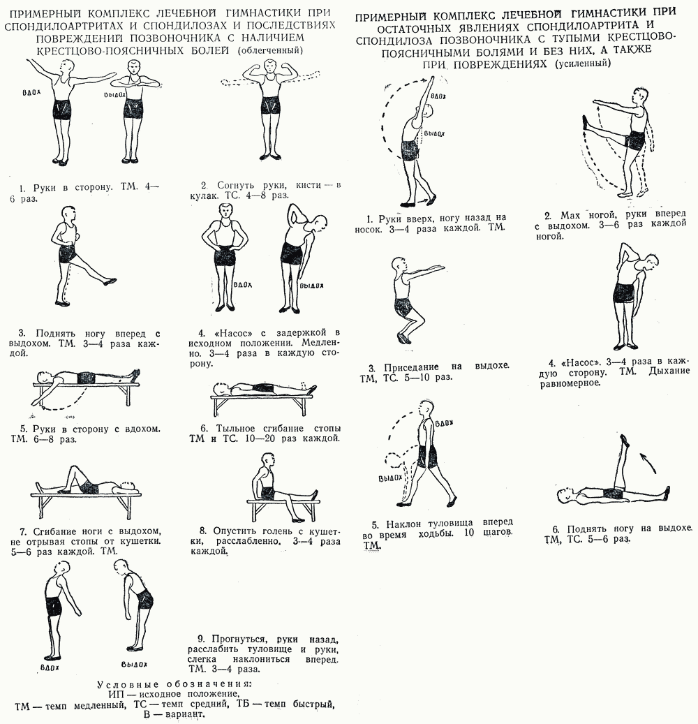 Упражнения при остеохондрозе