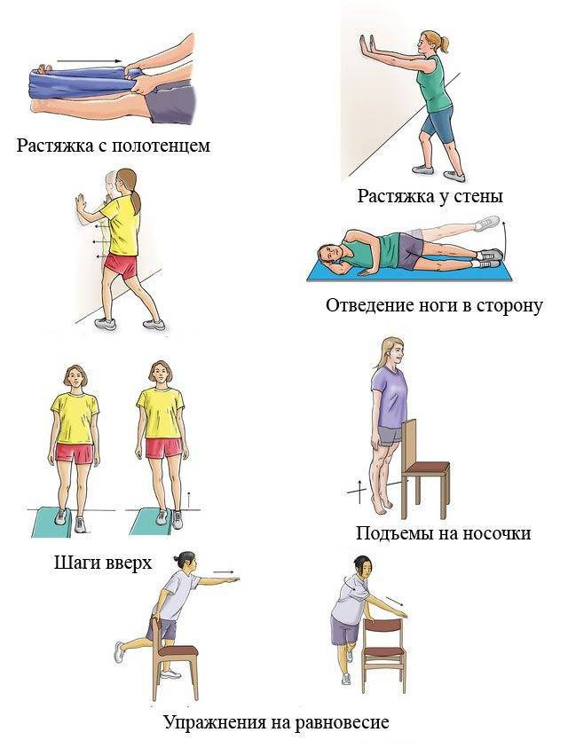 Лечебная гимнастика при артрозе коленного сустава: комплекс упражнений