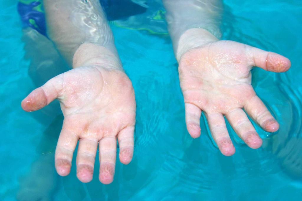 Аллергия на хлор в бассейне фото