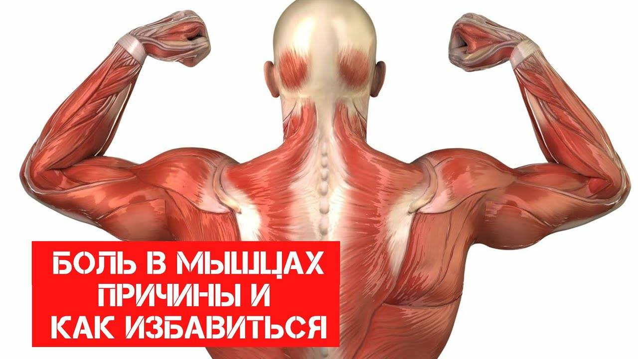 Боли в мышцах | артромедцентр
