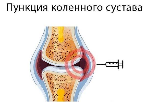 Почему болит колено у женщины: главные причины