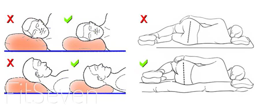 Как правильно спать при шейном остеохондрозе: подробные рекомендации