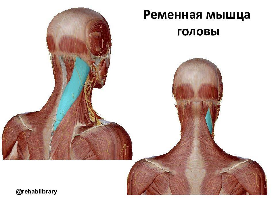 Ременная мышцы: когда болит голова и шея