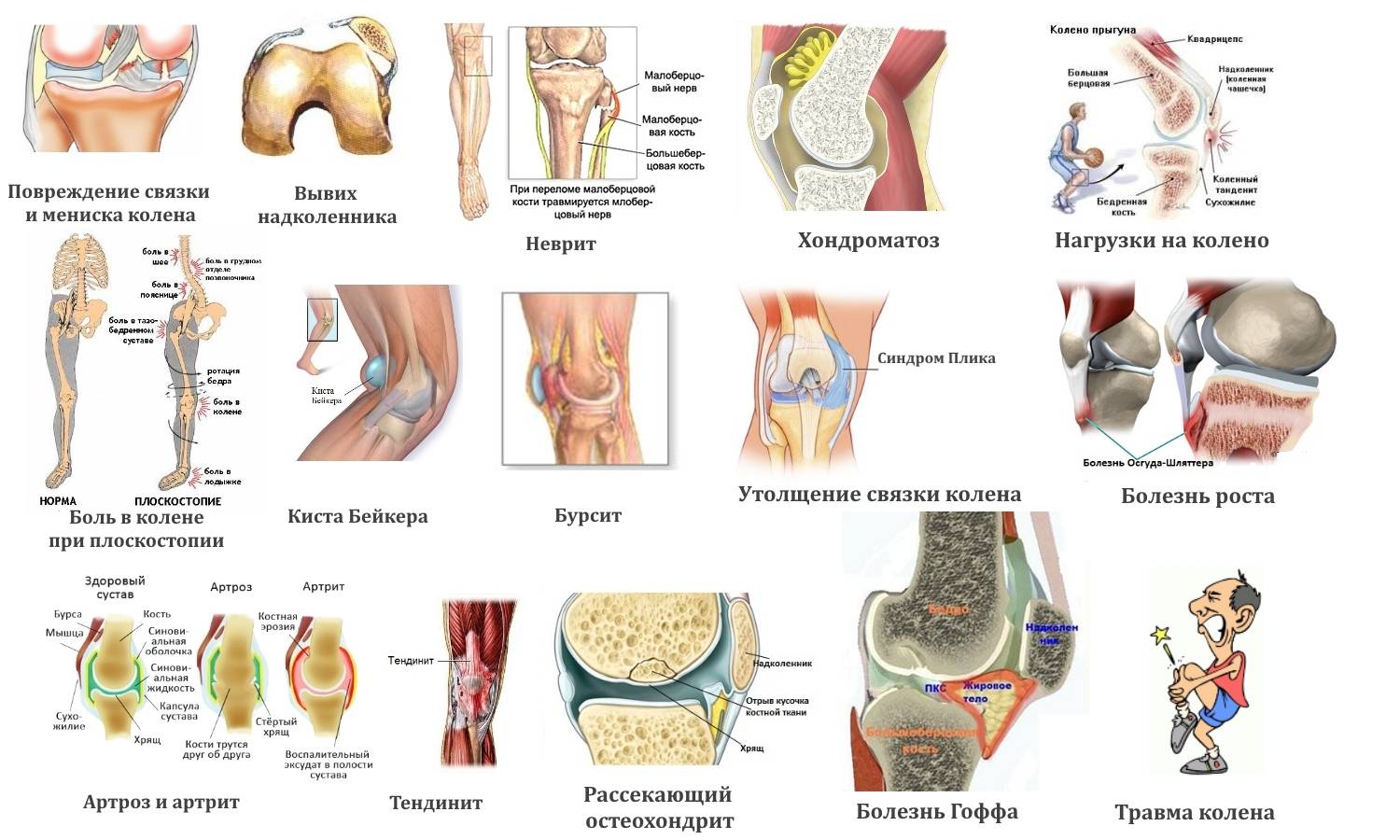 Боль в суставах (артралгия) : симптомы, причины и лечение