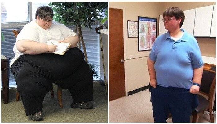 «я вешу 300 кг: что было дальше» — 5 драматических историй похудения с фото до и после
