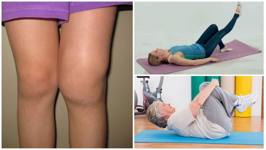 Лечение артроза коленного сустава при помощи увт
