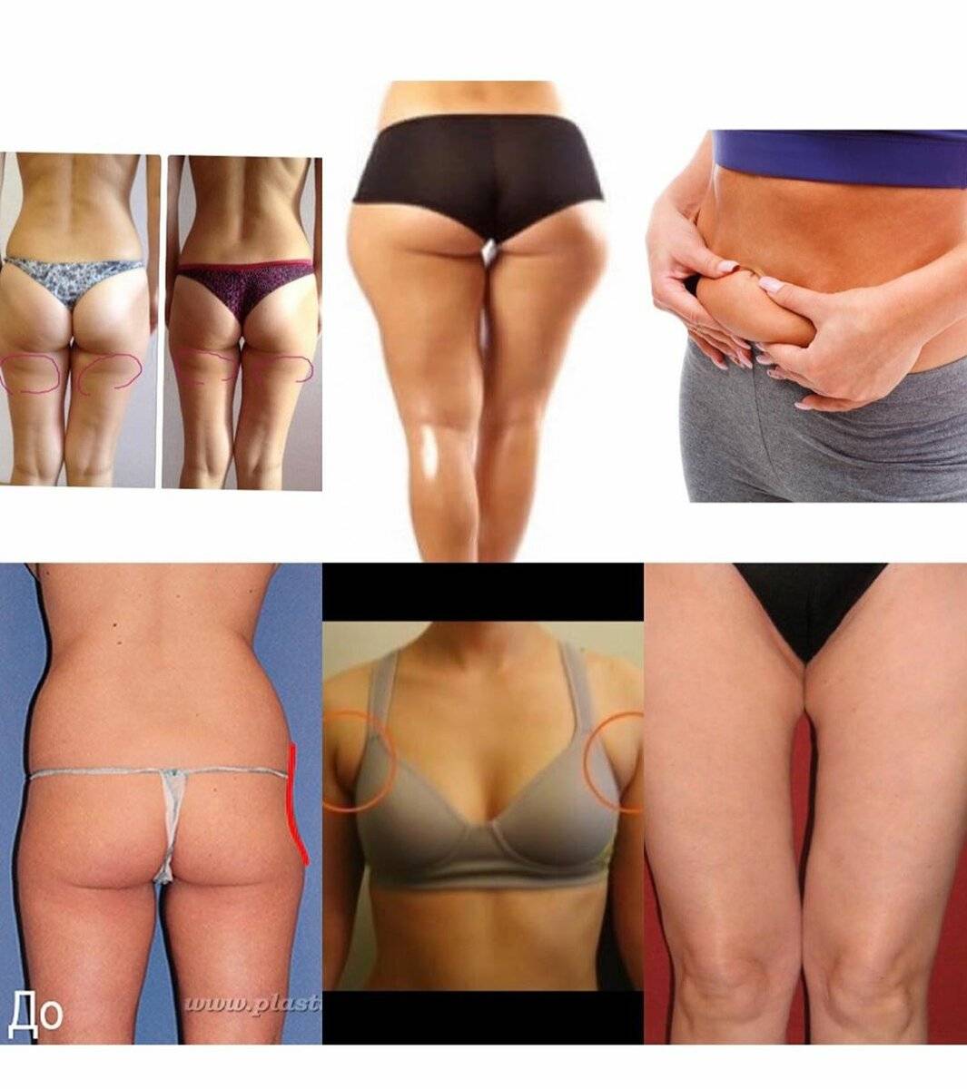 Липолитики для похудения - что это такое: инъекции липолитиков в живот, лицо, отзывы, фото до и после