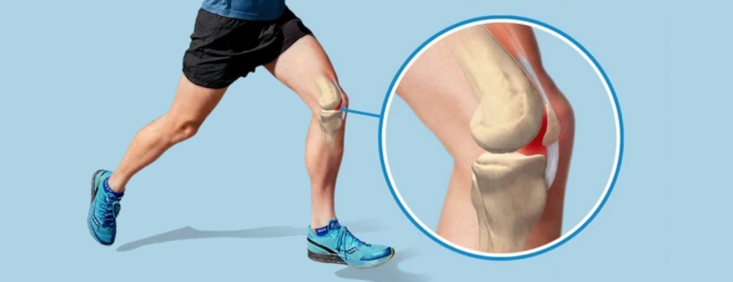 Боль в колене после тренировки: причины и способы устранения