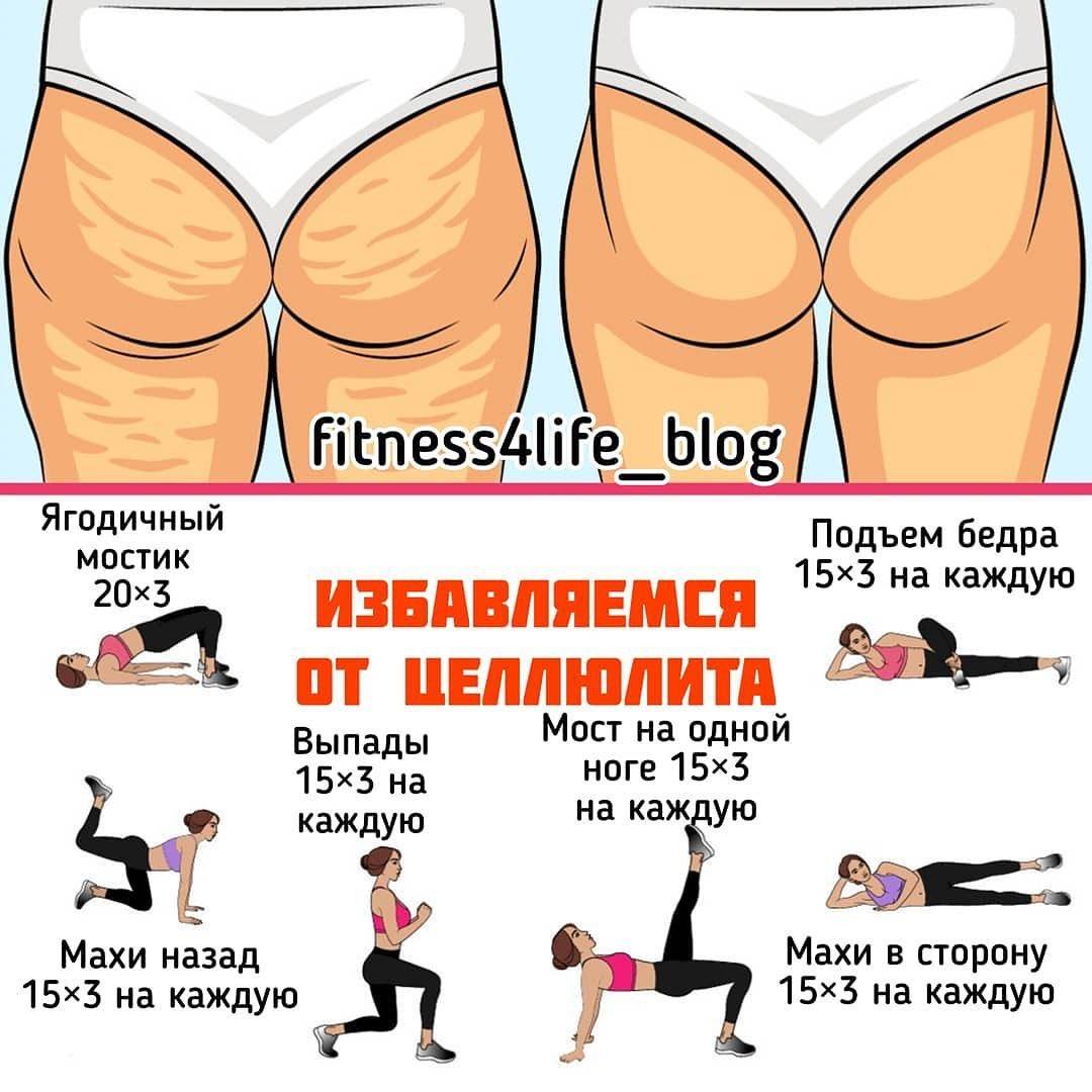 Как избавиться от целлюлита? причины и способы борьбы с целлюлитом