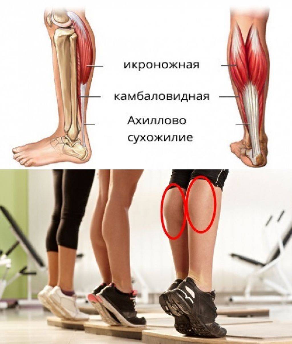 Упражнения для устранения отечности ног и варикозного расширения вен | лиотон® 1000