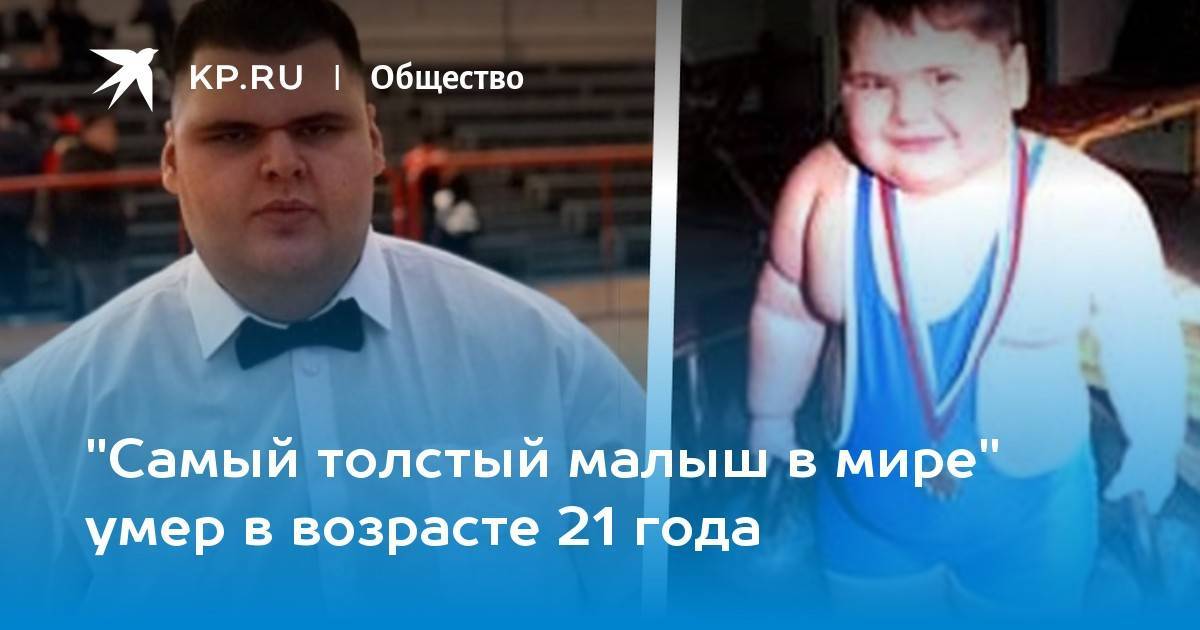 Удивительное до и после — что стало с самым толстым ребенком в мире: мы не поверили своим глазам!