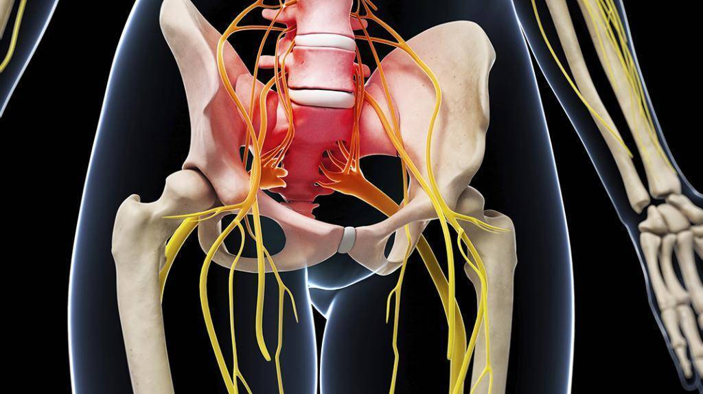 Защемление седалищного нерва: причины, симптомы и лечение ущемления седалищного нерва лечебным пластырем нанопласт форте
