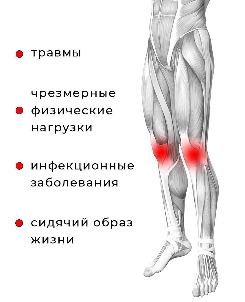 Острая и резкая боль в коленном суставе без травмы: причины и лечение