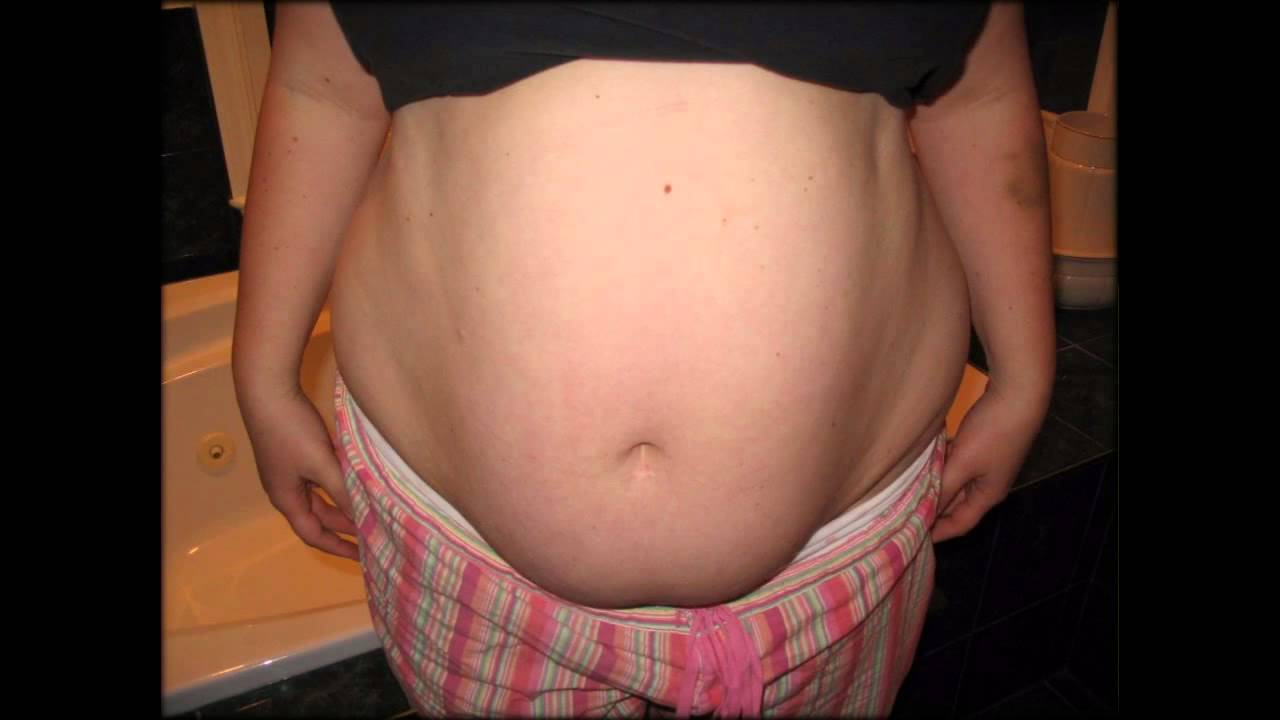 10 причин больших животов (кроме беременности): «сама худая, а живот торчит»