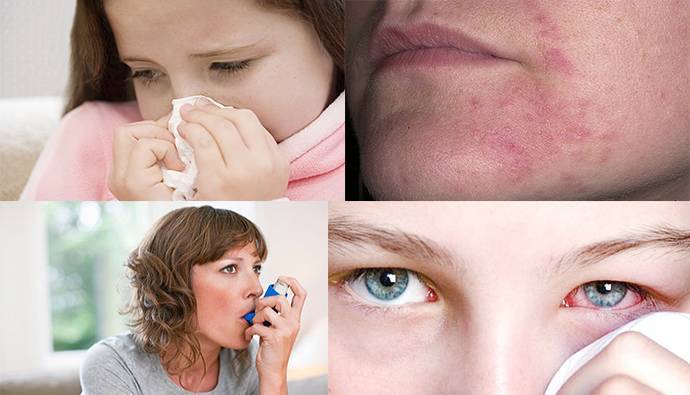 Аллергия: ликбез для аллергика. диагностика, симптомы, лечение | университетская клиника