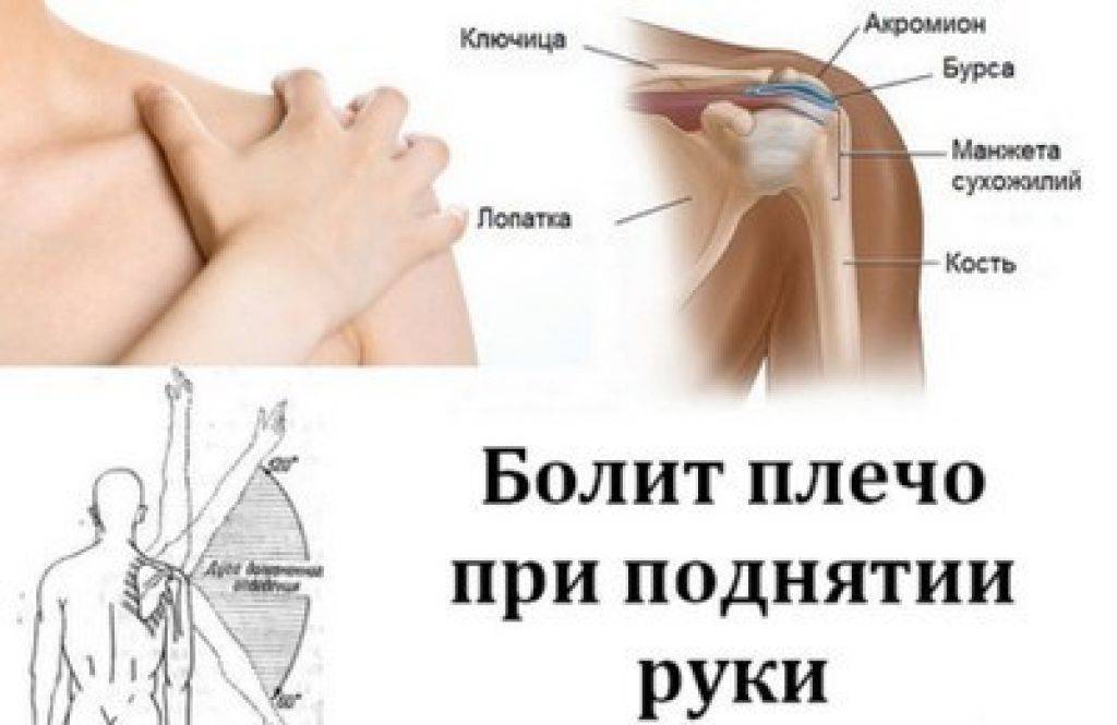 Боль в плече лечение в киеве ✔️ при поднятии руки в сторону